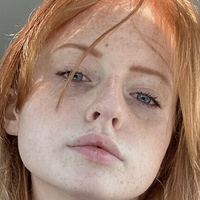 freckledstrawberrygirl Nahé