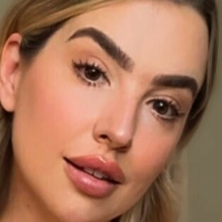 Kerion Mywayward Nahé