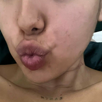 notyourbabyt Nahé