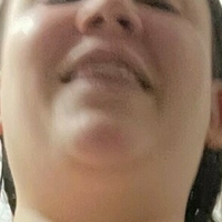 raventriplex Nahé