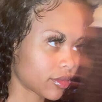 Rihannasforehead9 Nahé